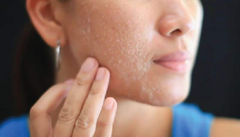 Foods to help us stay moisturised during winter