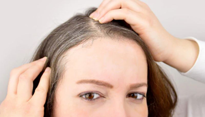 home remedies to reduce greying of Hair