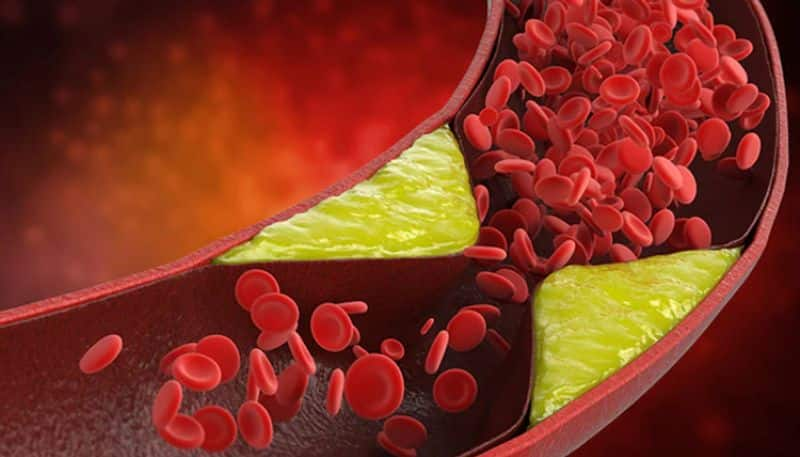 foods that help reduce high cholesterol levels