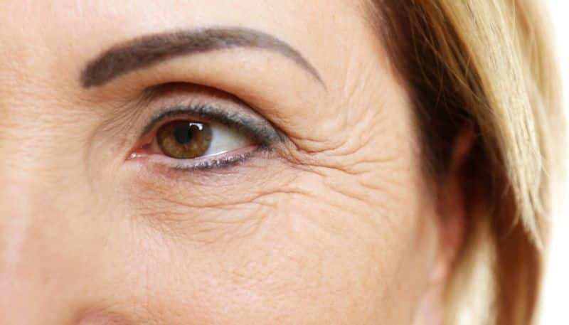 how to reduce wrinkles rsl