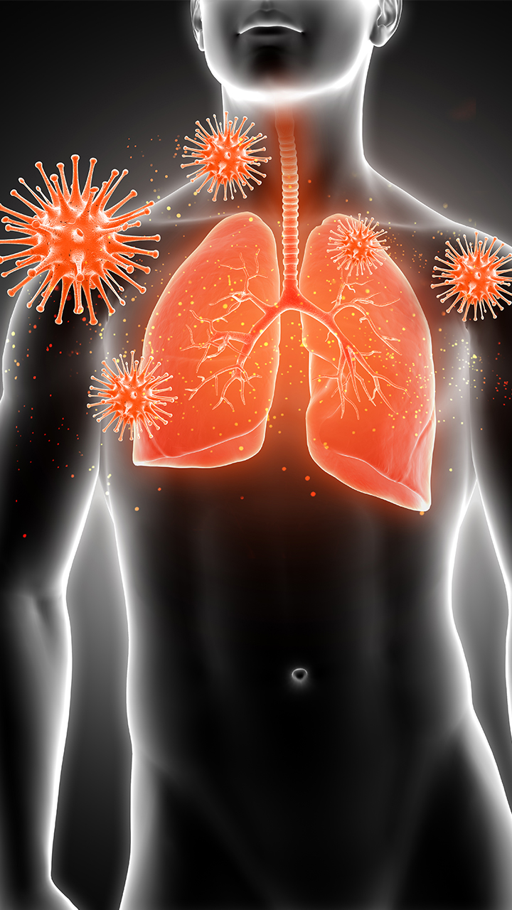 Indians face high risk of lung damage after severe Covid-19 Rya