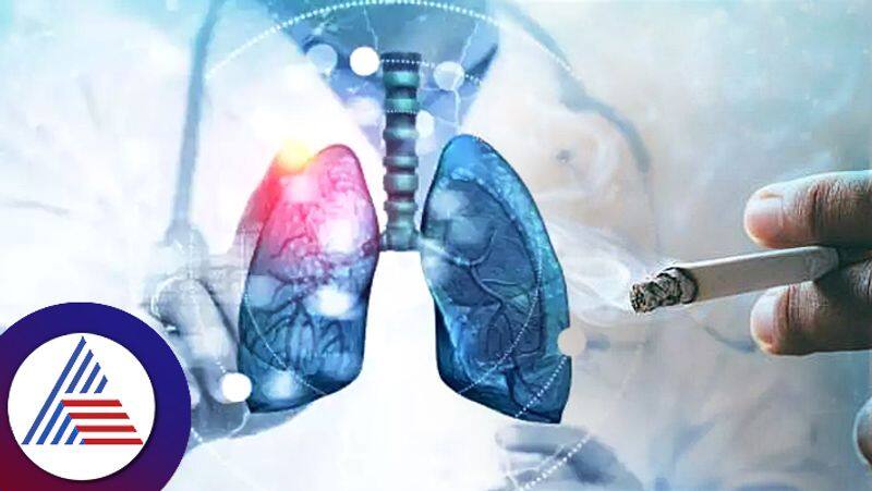 Lung Cancer: Know the Signs, causes, symptoms, and early detection RBA