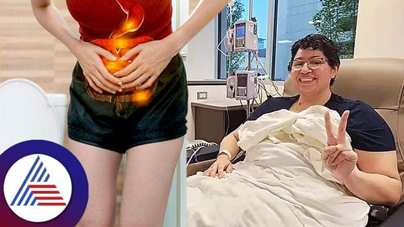 Women Go To Toilet Ten Times In A Day Diagnosed With Stage Four Colorectal Cancer roo