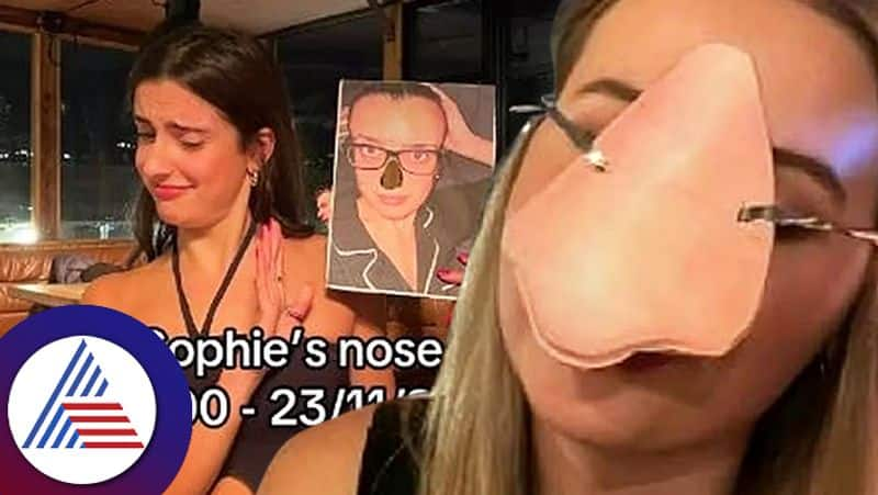 Woman Held Funeral For Her Old Nose Before Getting Its Rhinoplasty Praised roo