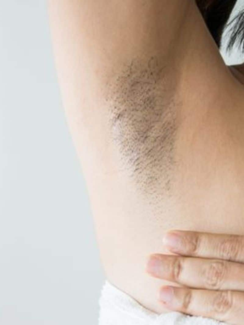 remedies  to get rid of black under arms  zkamn