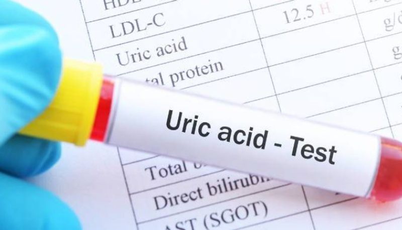 these foods can help lower uric acid levels