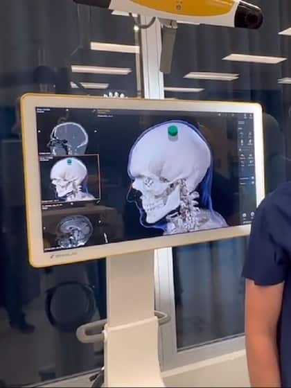 <p>बीते साल एलन मस्क की कम्पनी न्यूरालिंक को इंसानी दिमाग में चिप लगाने की मंजूरी यूएस फूड एंड ड्रग एडमिनिस्ट्रेशन की तरफ से दी गई थी।</p>
