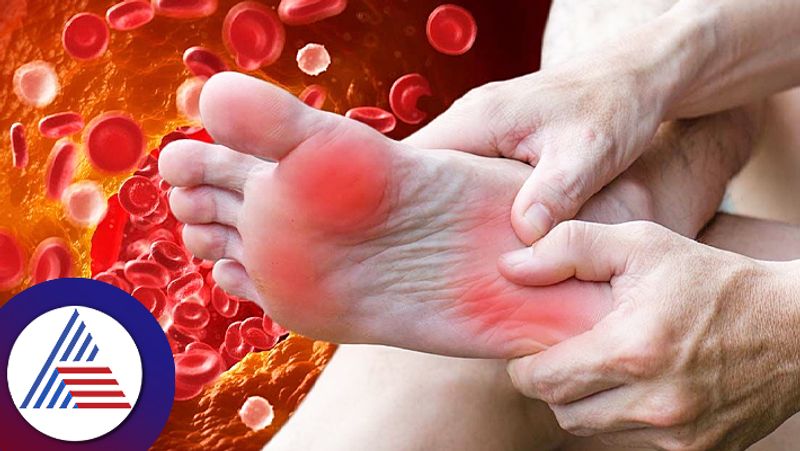 The cracks in your feet might be telling you something about your liver skr