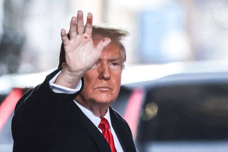 Donald Trump raises possibility of AI involvement in mysterious red marks on his hands avv