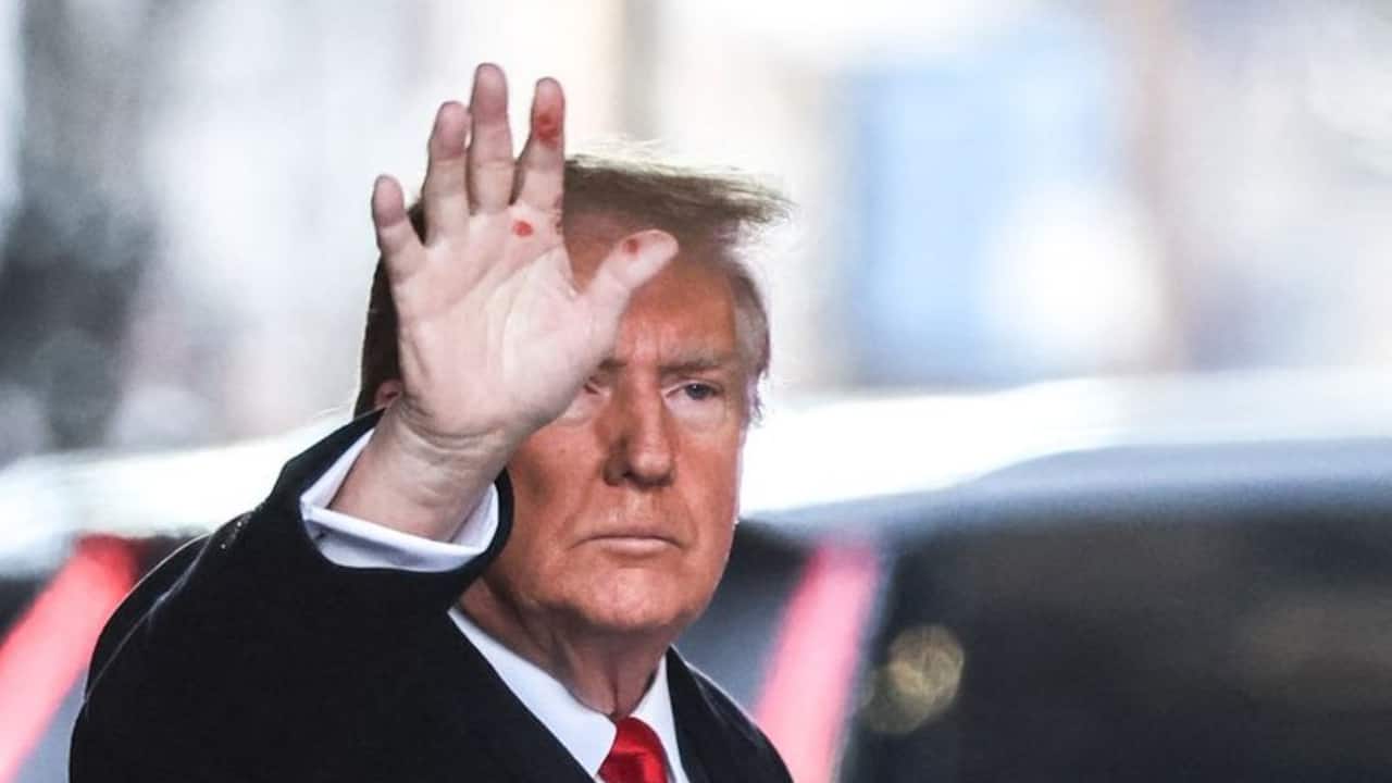 Donald Trump raises possibility of AI involvement in mysterious red marks on his hands