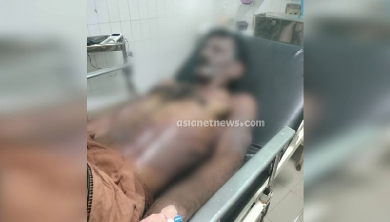 Acid attack on young man in kannur, serious injury, police case