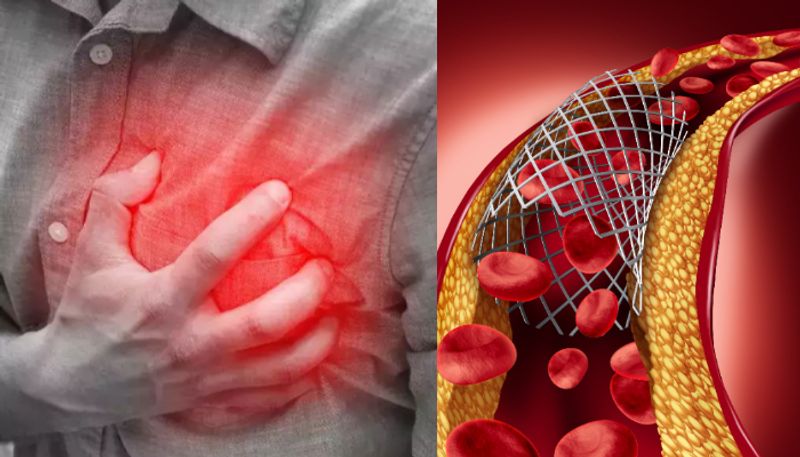 symptoms of cholesterol and tips to manage it