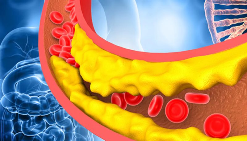 8 vegetables to lower cholesterol level 