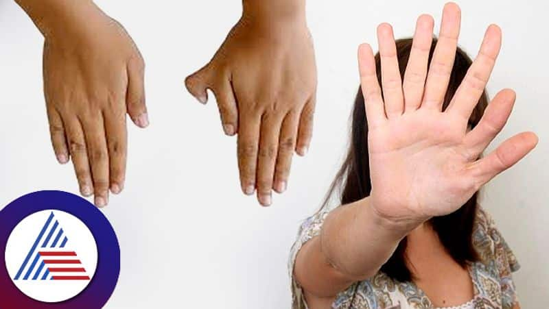 Why some people get more fingers in hand