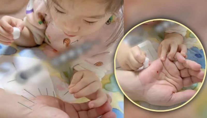 five year old inserting acupuncture needles discussions in Chinese social media rlp