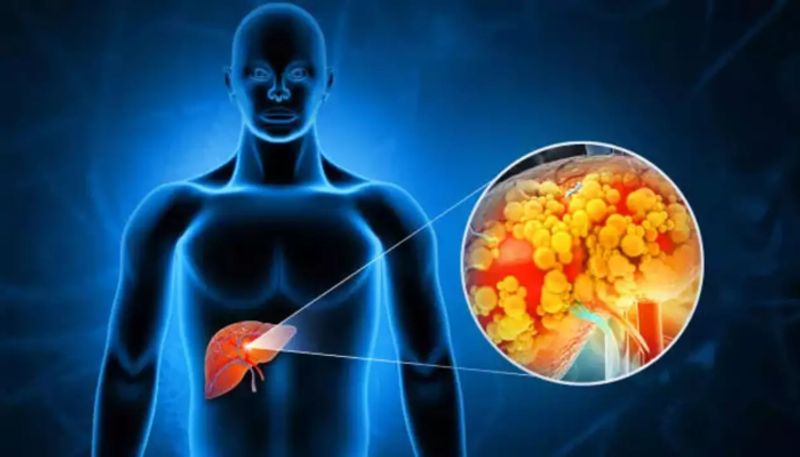 warning signs of liver cancer one must not ignore