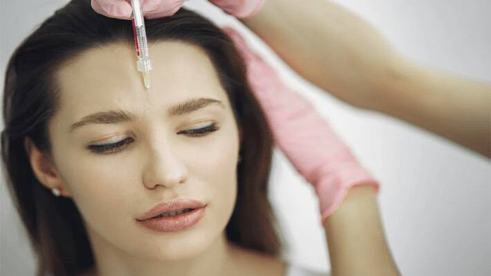 botox treatment