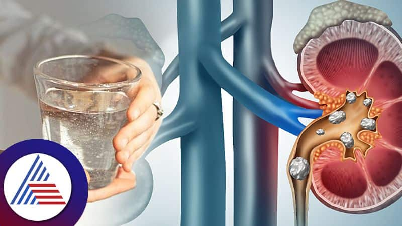 How hot water affect your kidney pav