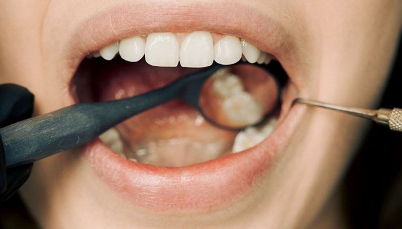 Top signs of mouth cancer that can be seen in your teeth