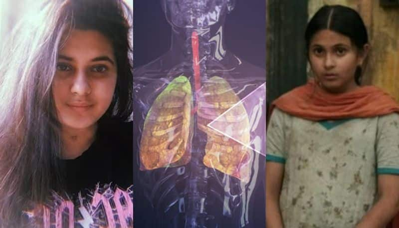 Know all about of dermatomyositis cause Dangal actor Suhani Bhatnagar Death san