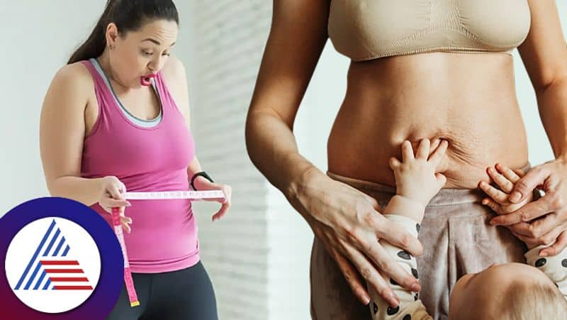 What is the most effective way to lose weight after having a baby? rsl