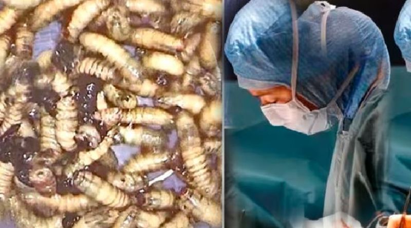 Mans face and lip swelling leads doctors to discover 150 larva stage bugs inside nose Vin