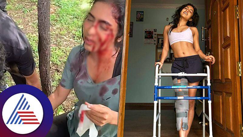 Actress Samyuktha Hegde leg injured during kreem movie shooting srb