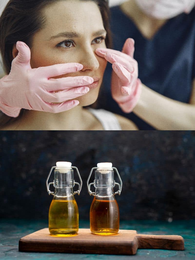 How to use mustard oil for nose shaping? rkn