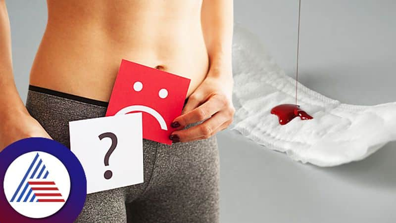 Reasons for vaginal bleeding in women other than periods pav