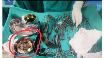 New Delhi young man suffering schizophrenia swallowed coins and magnet doctor surgery in Gangaram Hospital. XSMN 