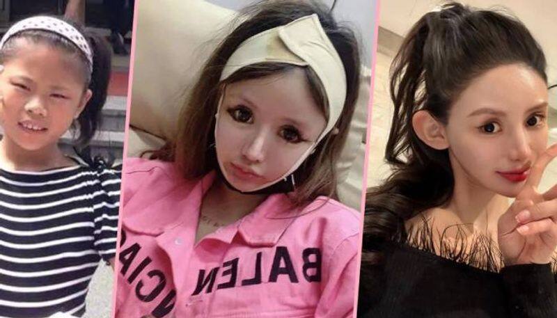 Chinese teenage girl completed 100 plastic surgeries to look like a star spend four crore rlp