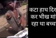 man caught fake injury of beggar zkamn