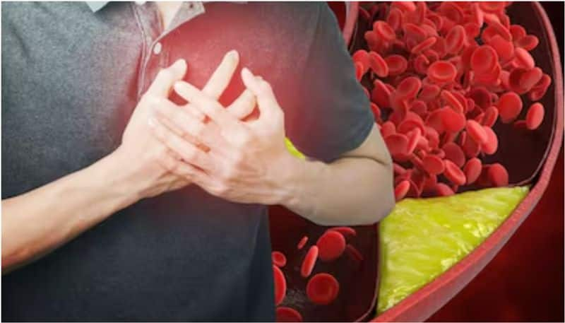 High Cholesterol In Men: Top 7 Easy Tips To Control Excessive Bad Cholesterol Levels Naturally Rya