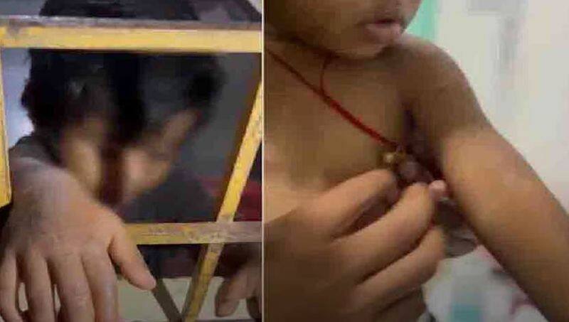 a mother tortured a three year old child in bengaluru gvd