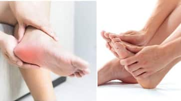 plantar fasciitis is main cause of Plantar fasciitis know how to relief from doctor irfan ahmed  xbw