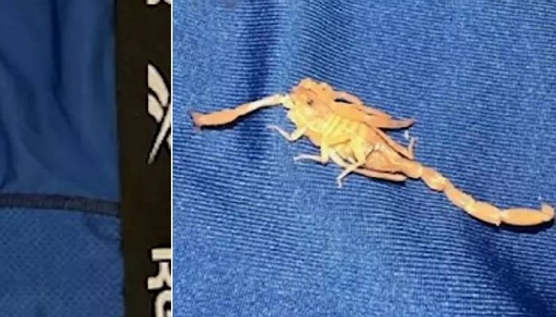 man bitten by scorpion in private parts sues las vegas hotel rlp