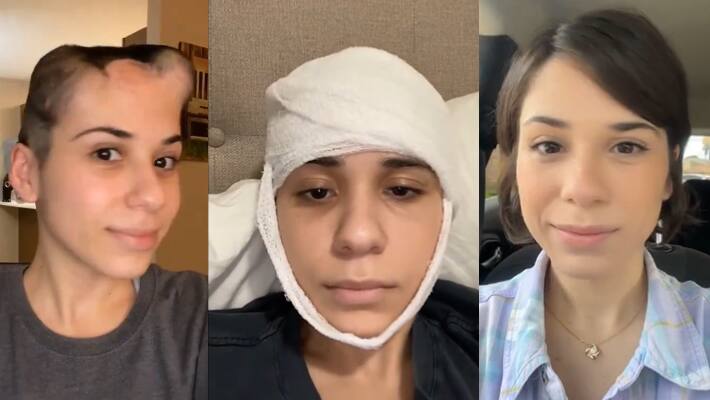 story-of-a-cancer-survivor-women-goes-viral