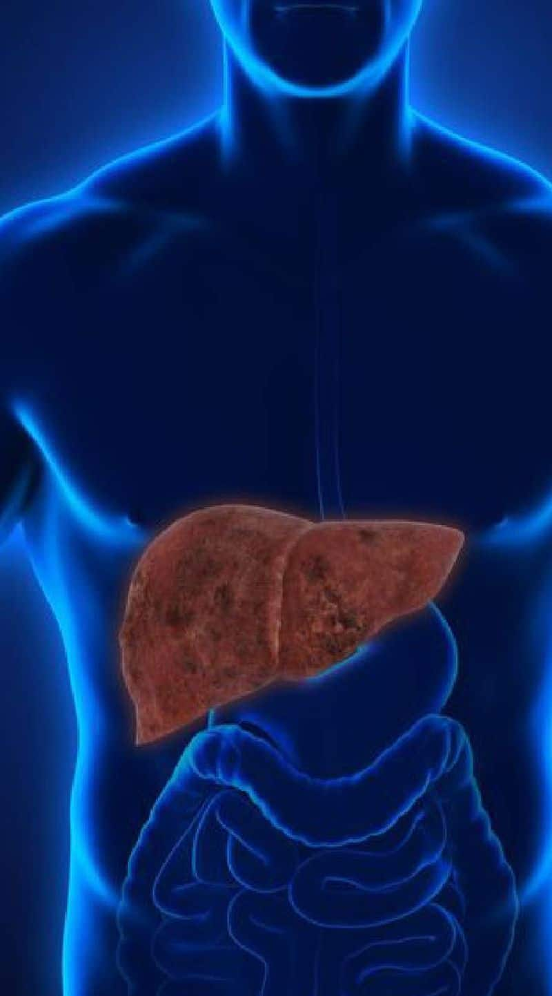 avoid fatty liver by include these foods in your diet today xbw 