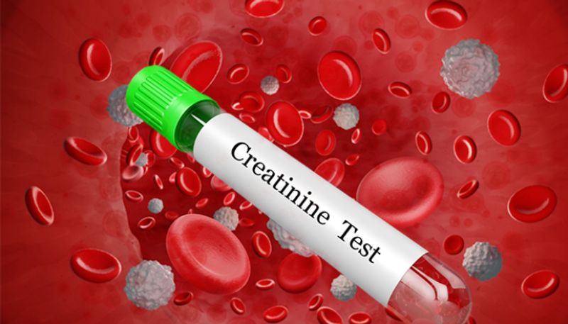 symptoms of High creatinine levels in blood 