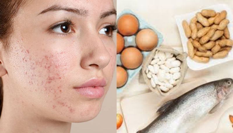 foods that can secretly trigger skin allergies