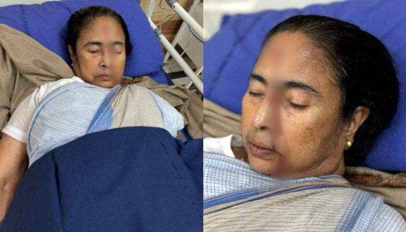 West Bengal Chief Minister Mamata Banerjee suffered severe head injuries and stitches after someone pushed her from behind RMA