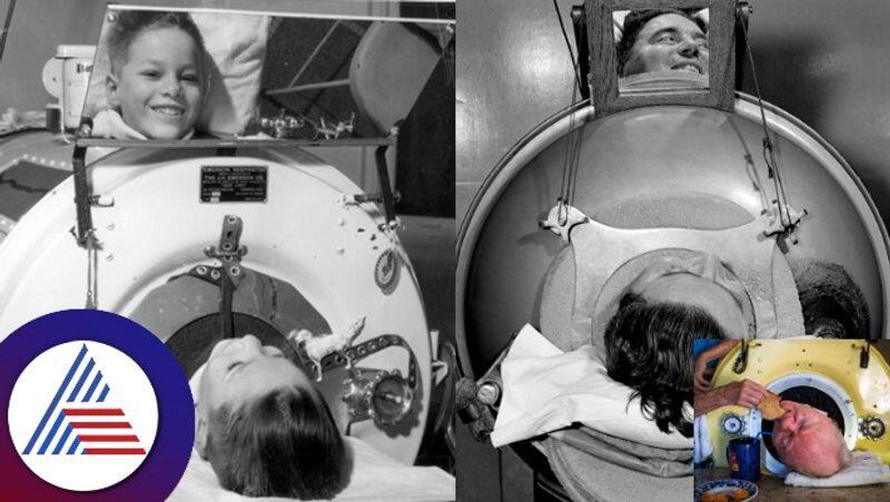 Paul Alexander Man in an iron lung since age 6 dies at 78 skr