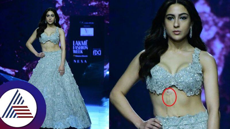 Fans praise Sara Ali Khan for not hiding her burn marks while walking the ramp suc