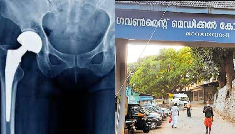 Sickle cell patient undergoes successful hip replacement surgery in Wayanad Medical College