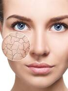 Summer Beauty tips: Follow THESE tips to take care of dry skin