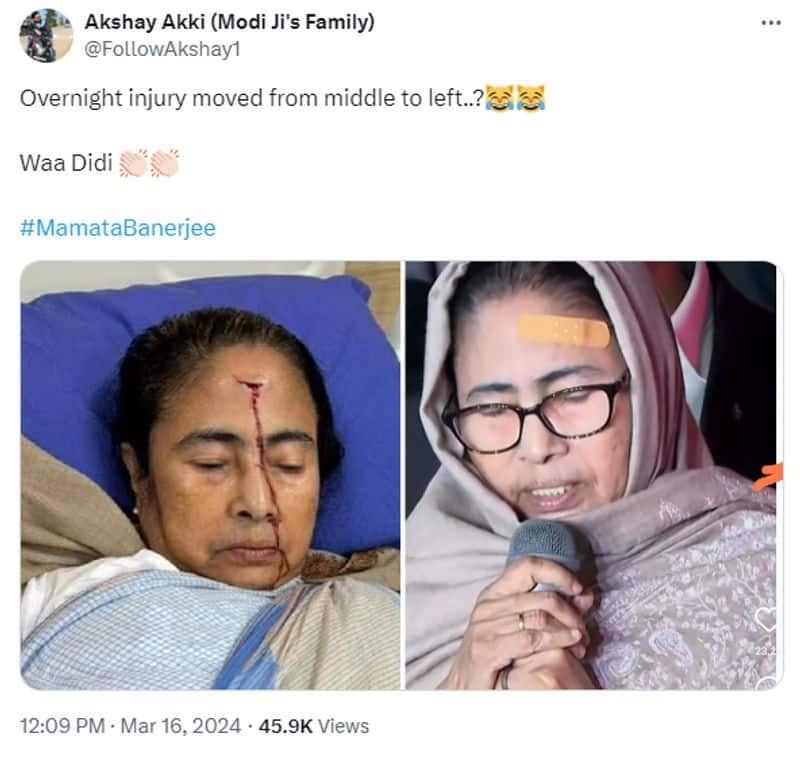 Fact Check Fake photo of Mamata Banerjee injury circulating in social media