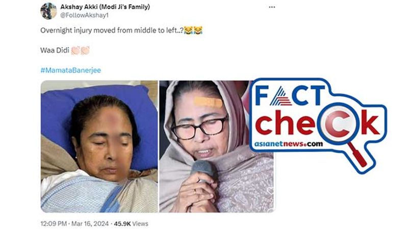 Fact Check Fake photo of Mamata Banerjee injury circulating in social media