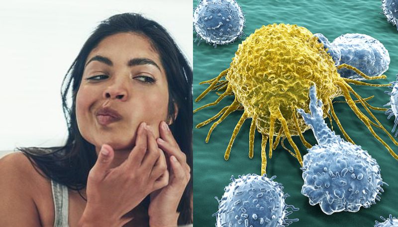 Viral beauty tips which can lead to skin cancer