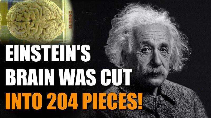 Did you know? Albert Einstein's brain was stolen, cut into 240 pieces! (WATCH) snt