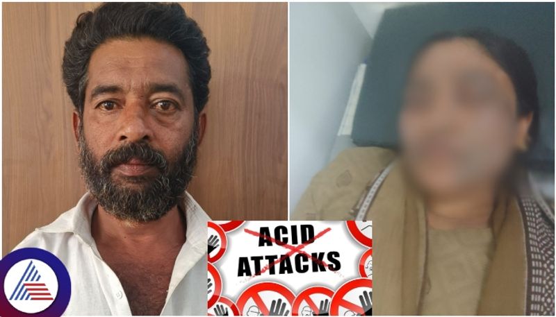 Bengaluru husband Chandpasha Acid attacked his wife face in Anekal sat